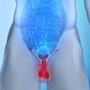 Cancerul de prostată la bărbați: simptome, tratamentul prostatei