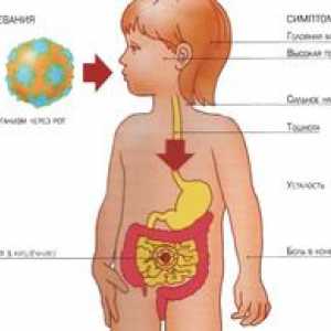 Infecția cu rotavirus: simptome și tratament. Rotavirus la copii