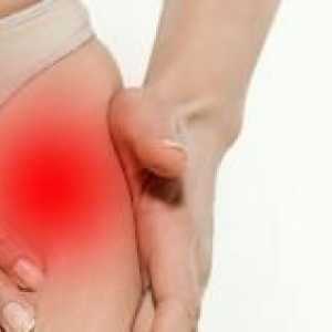 Simptomele și tratamentul artritei de șold
