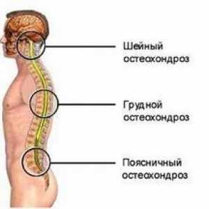 Simptomele osteocondrozei coloanei vertebrale și toracice