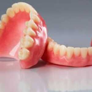 Proteză dentară detașabilă așa cum se întâmplă