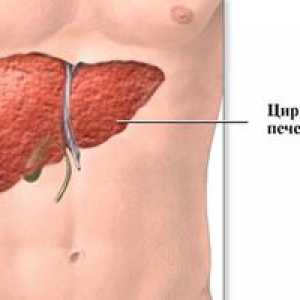 Distrugerea simptomelor de ciroză hepatică la femei