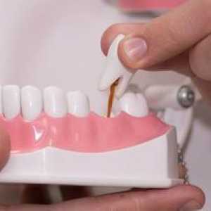 Opțiuni pentru înlocuirea dinților: înlocuirea opțiunilor dinților pentru proteze