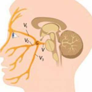 Inflamația nervului trigeminal, simptome și tratament