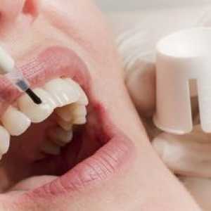 Refacerea smalțului dinților: metode de restaurare a smalțului dinților