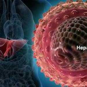 Este icterul un virus de ce fel de hepatită?