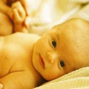 Icterul la nou-născuți: cauzele apariției, tratamentului și consecințelor