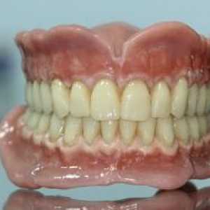 Proteze dentare complete, tipuri și costuri dentare
